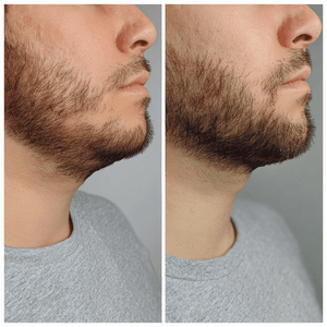 Papada preset preview